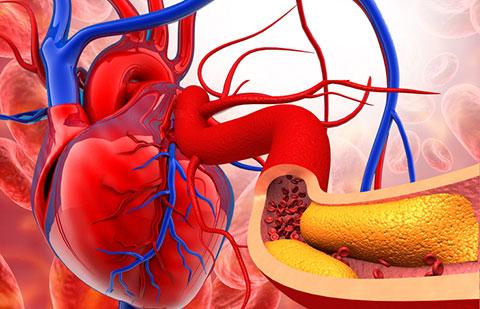 Herbal care for heart and circulatory disorders