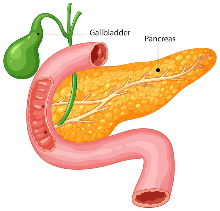 Doctor explaining about Pancreatic Diabetes