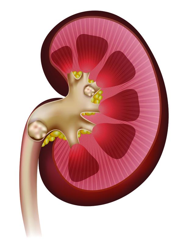Herbal medicines for kidney stone relief
