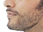 Stage 3