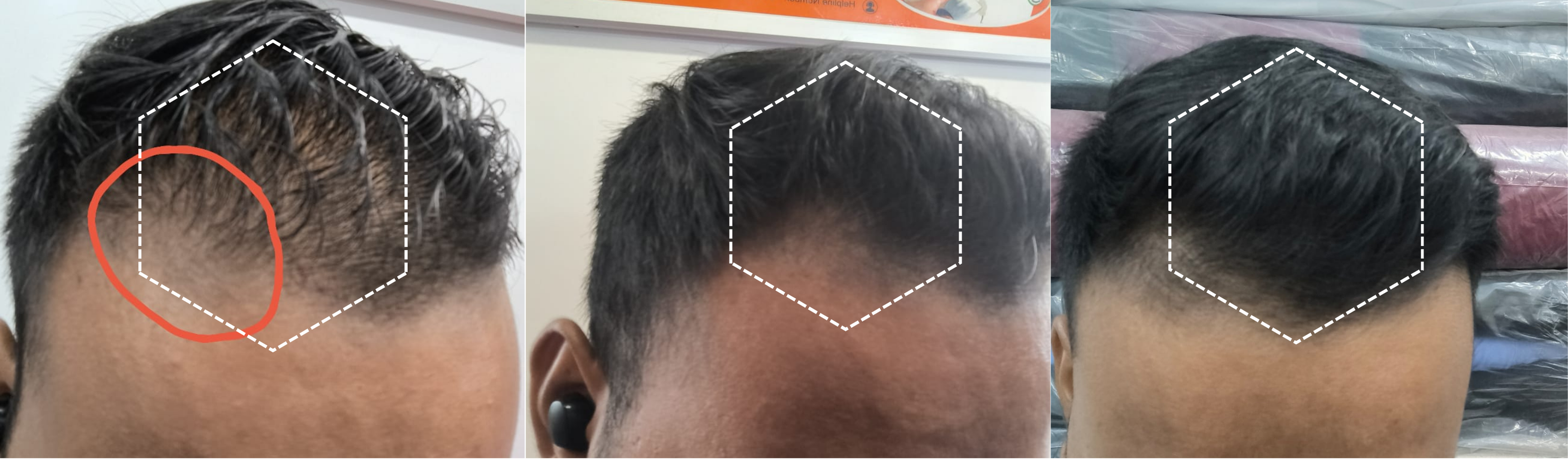 Review 3